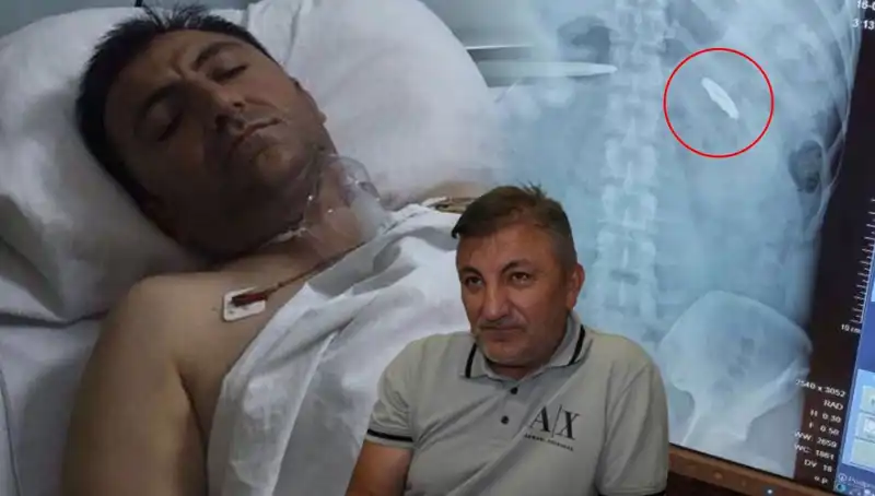 15 Temmuz’un Acı İzleri: 9 Yıldır Vücudundaki Kurşunla Yaşayan Kahraman