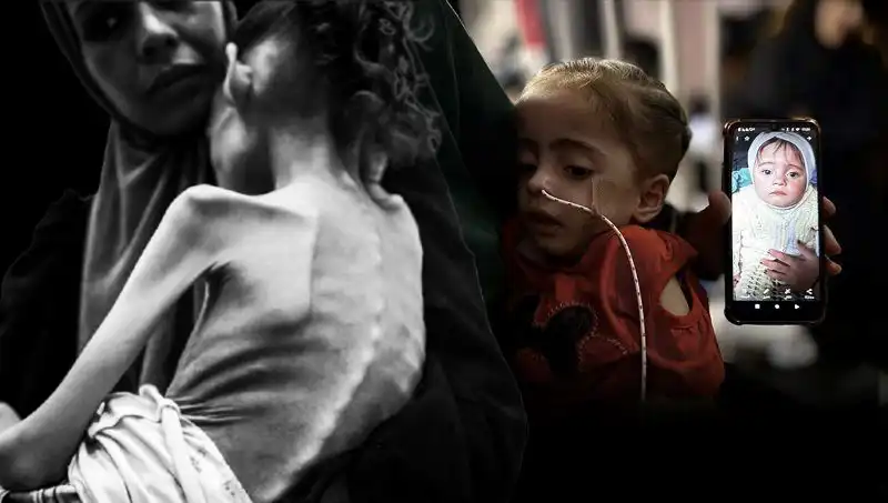 Küçük Meryem'in Hayatı Tehlikede: 25 Kilodan 10 Kiloya Düşen Çocuk Açlıkla Mücadele Ediyor